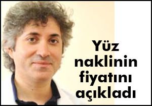 Yüz naklinin fiyatını açıkladı